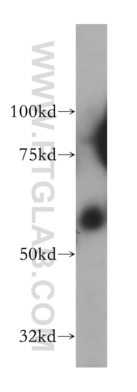 13255-1-AP;human colon tissue