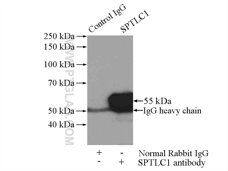 15376-1-AP;HEK-293 cells