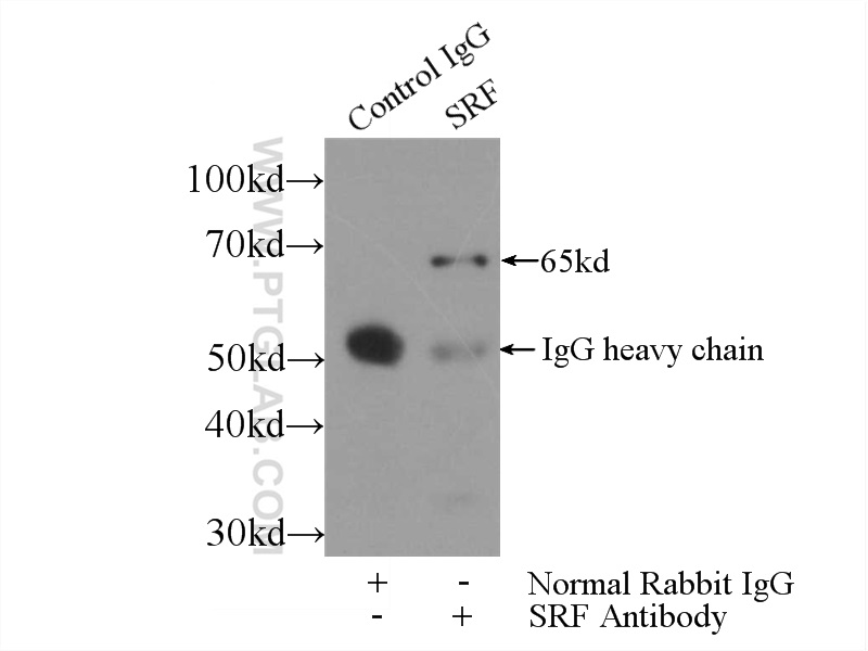 16821-1-AP;HeLa cells