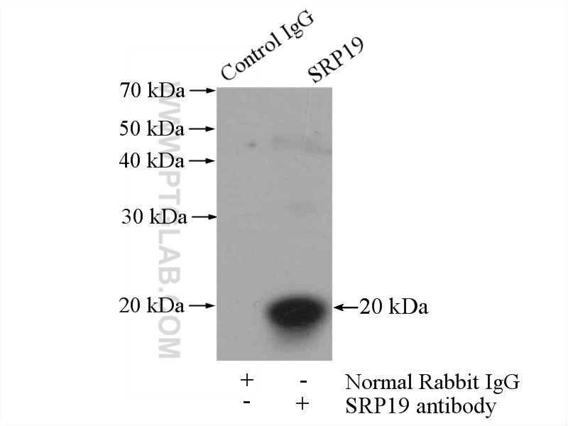 16033-1-AP;mouse kidney tissue