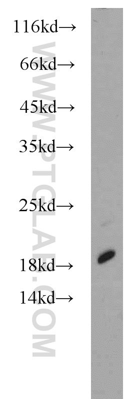 16033-1-AP;human liver tissue