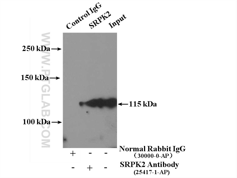 25417-1-AP;HeLa cells