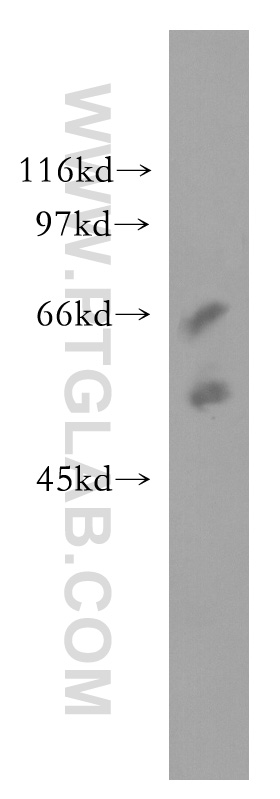 51029-2-AP;human placenta tissue