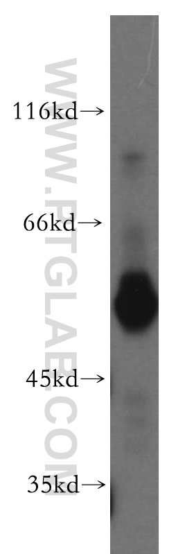 13154-1-AP;human placenta tissue