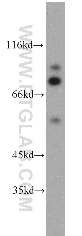 13179-1-AP;K-562 cell