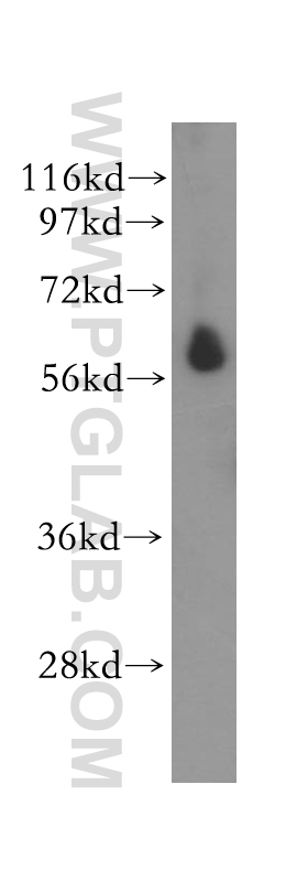 11434-1-AP;human heart tissue