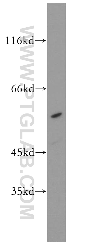 11105-1-AP;MCF7 cells