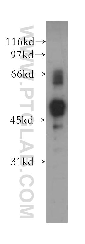 12697-1-AP;A375 cell