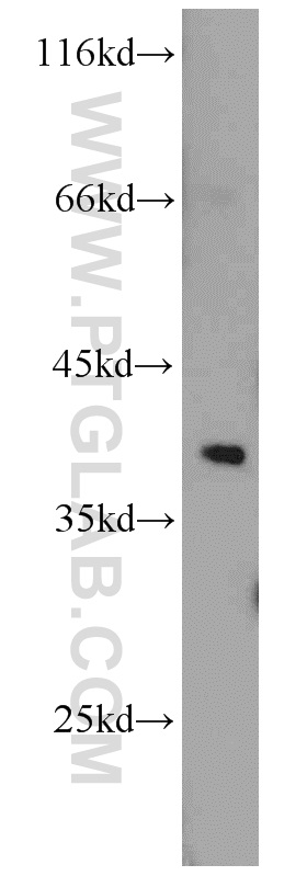 18277-1-AP;mouse brain tissue