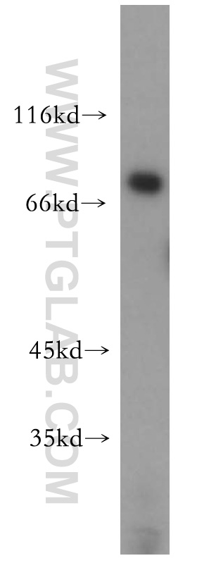 17362-1-AP;PC-3 cells