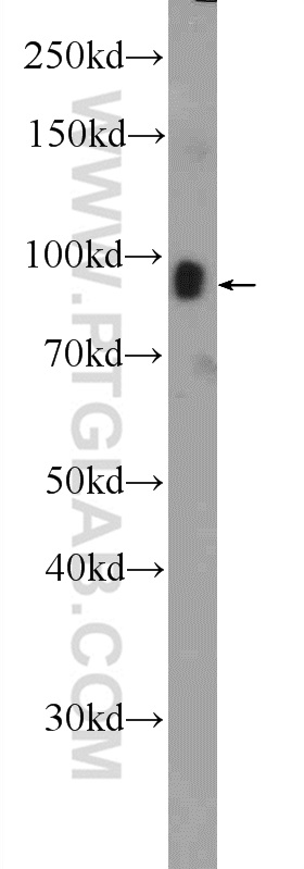 23966-1-AP;mouse heart tissue