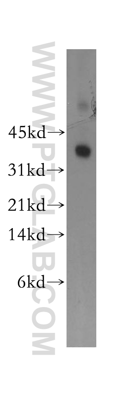 13301-1-AP;human placenta tissue