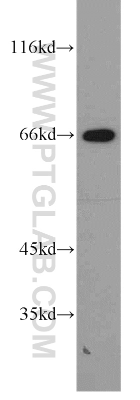 15312-1-AP;K-562 cells