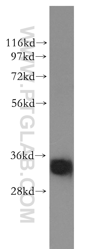 11376-1-AP;human colon tissue