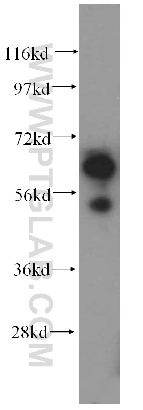 15075-1-AP;human liver tissue