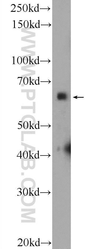 16573-1-AP;mouse brain tissue