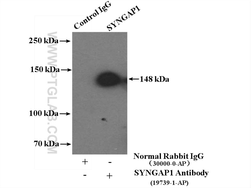 19739-1-AP;mouse brain tissue