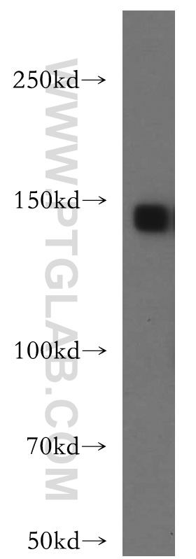 19739-1-AP;mouse brain tissue