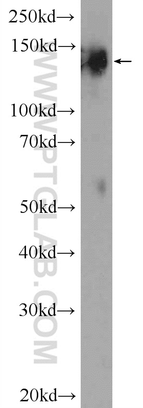 24677-1-AP;mouse brain tissue