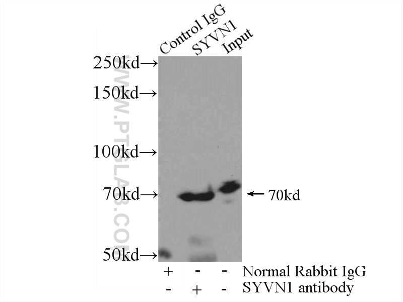 13473-1-AP;mouse kidney tissue