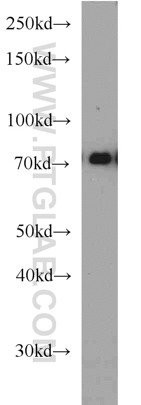 13473-1-AP;HEK-293 cells