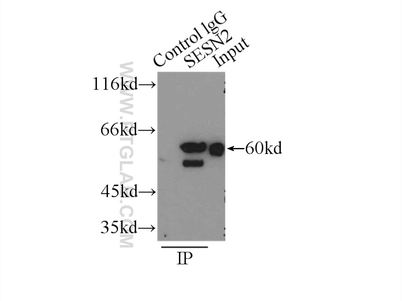 10795-1-AP;K-562 cells