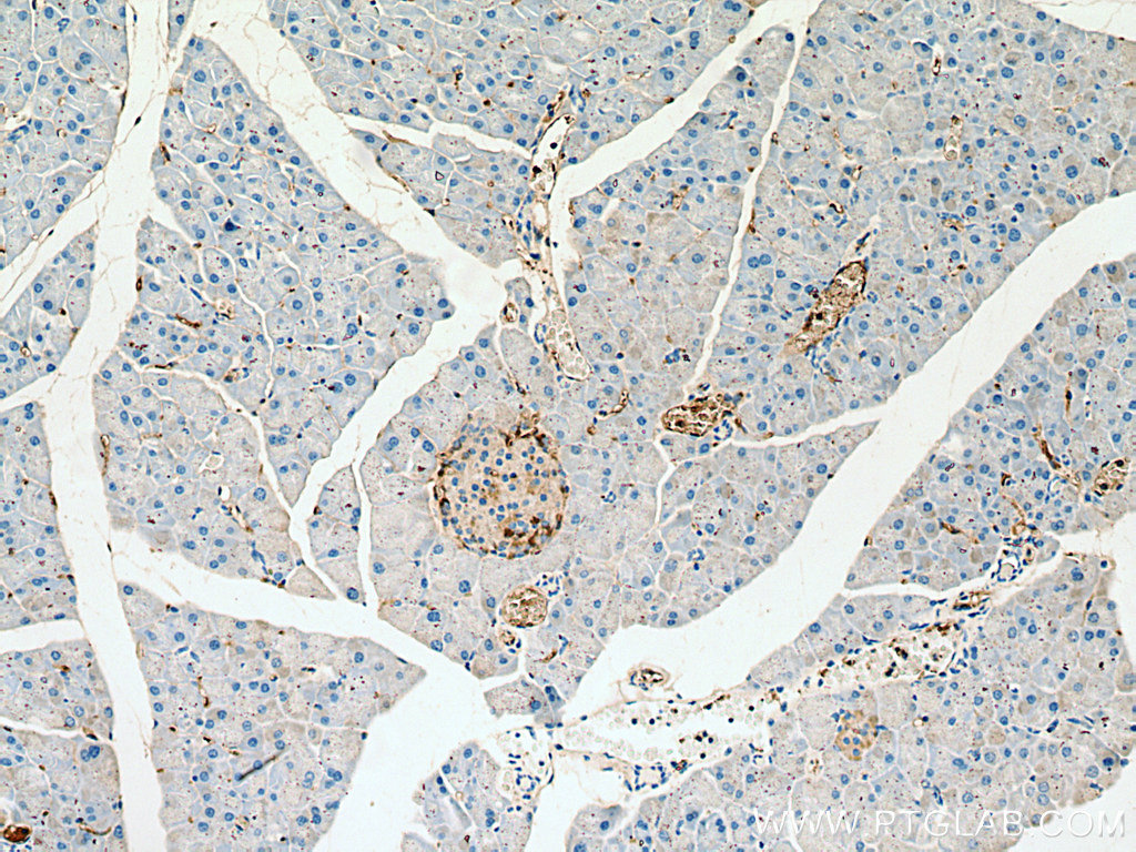 Somatostatin Aa Antibody Ap Proteintech