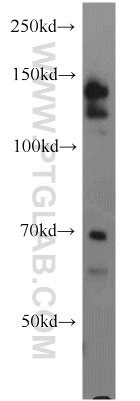 13862-1-AP;MCF7 cell