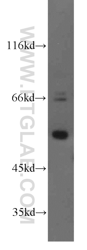 17367-1-AP;K-562 cell