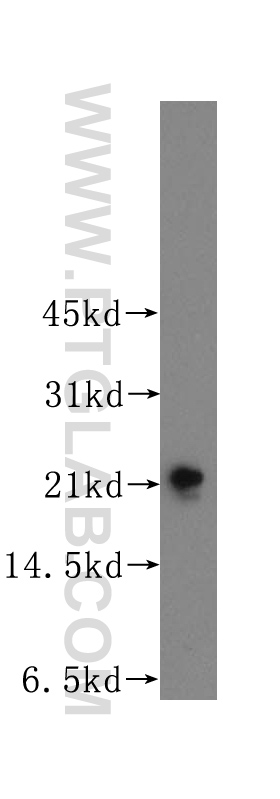 12246-1-AP;mouse brain tissue