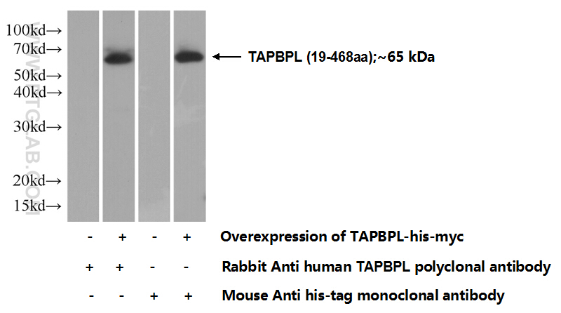 20522-1-AP;Transfected HEK-293 cells