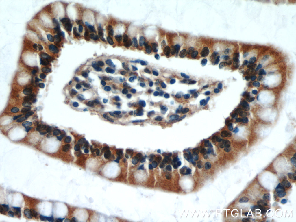 11692-1-AP;human small intestine tissue