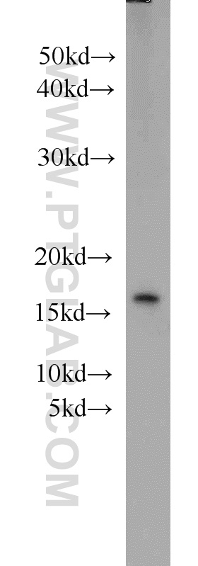 11692-1-AP;mouse ovary tissue