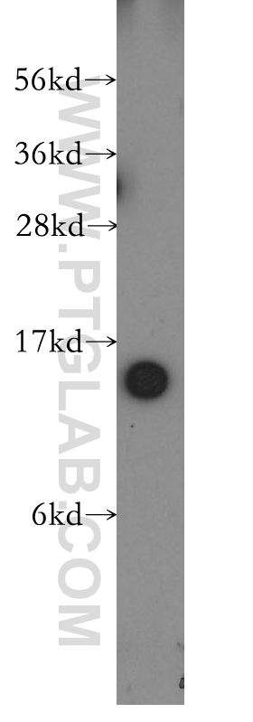 12304-1-AP;human brain tissue