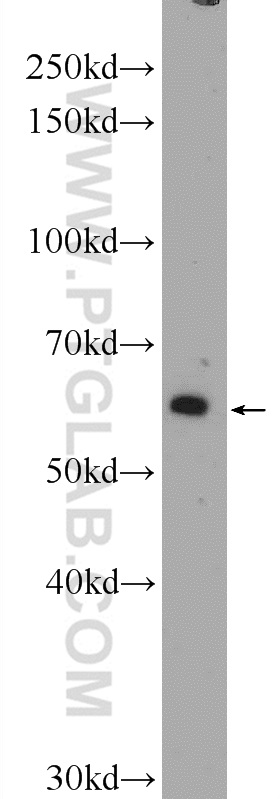 55312-1-AP;mouse brain tissue