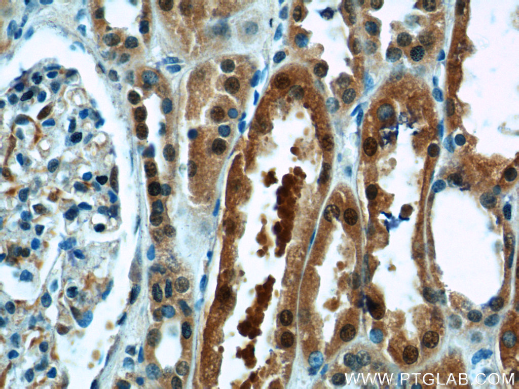 23237-1-AP;human kidney tissue