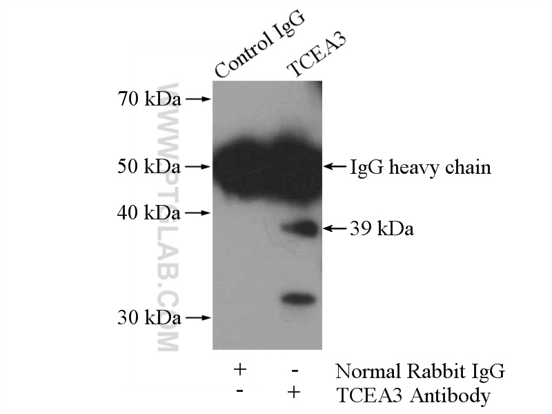 17158-1-AP;HeLa cells