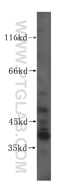 17158-1-AP;HeLa cell