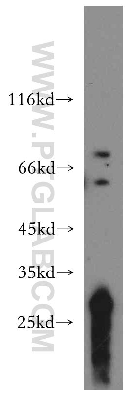 12649-1-AP;HL-60 cells