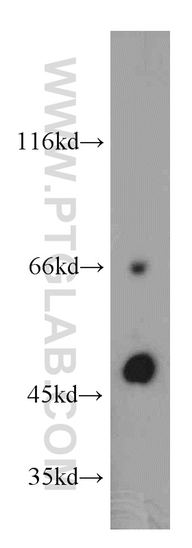 12157-1-AP;A375 cells