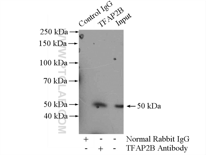 13183-1-AP;MCF-7 cells