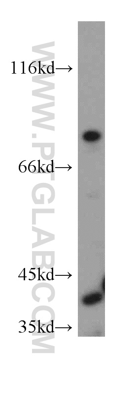 20865-1-AP;HeLa cell