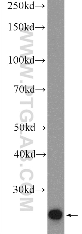 12584-1-AP;HEK-293 cells