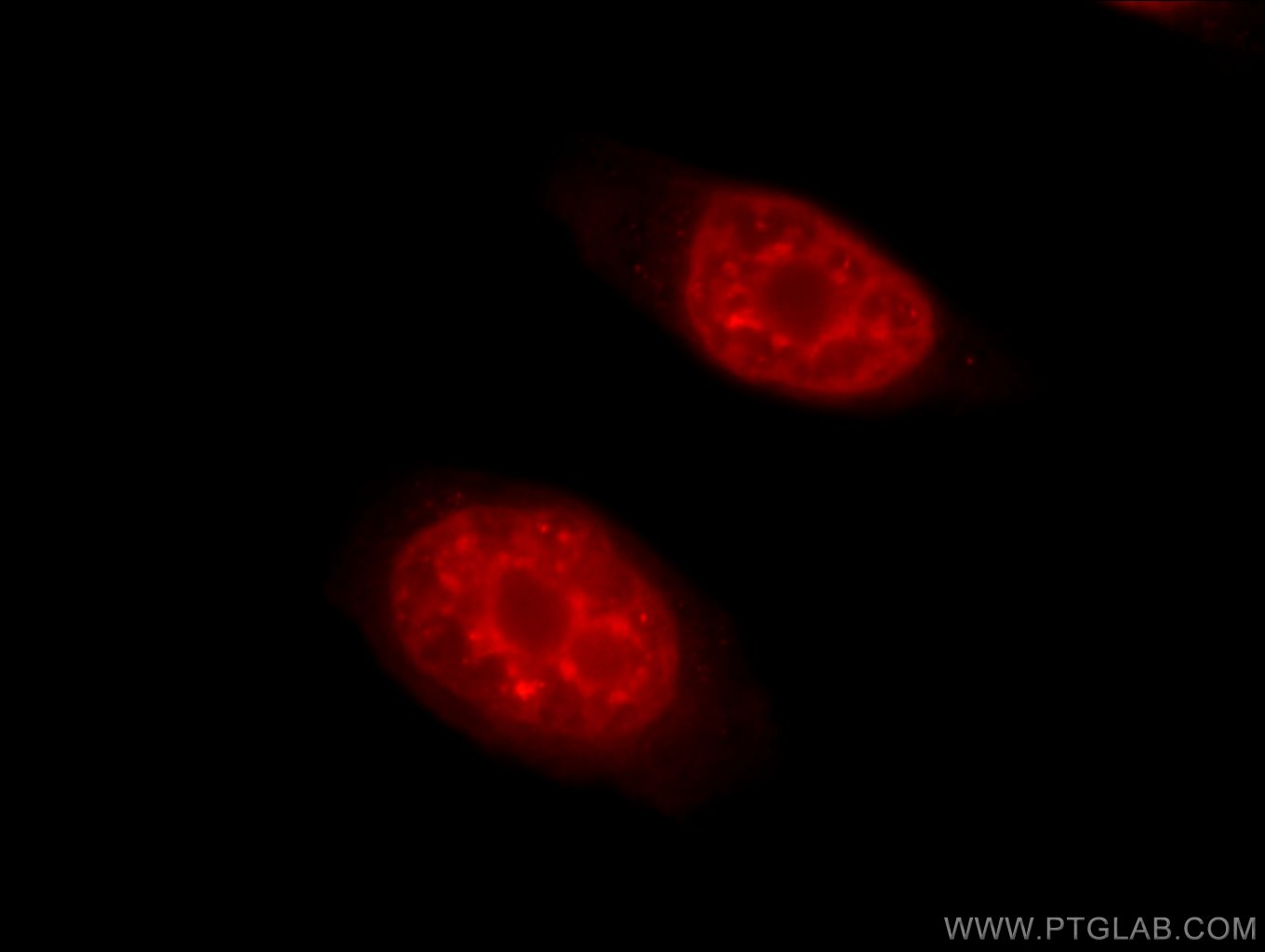 55178-1-AP;HeLa cells