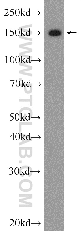 55178-1-AP;HeLa cells