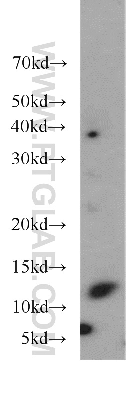 20328-1-AP;PC-3 cell