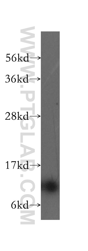 11973-1-AP;PC-3 cell