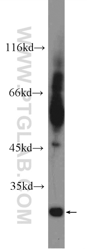 12326-1-AP;fetal human brain tissue