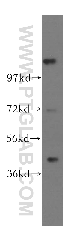 11972-2-AP;human brain tissue