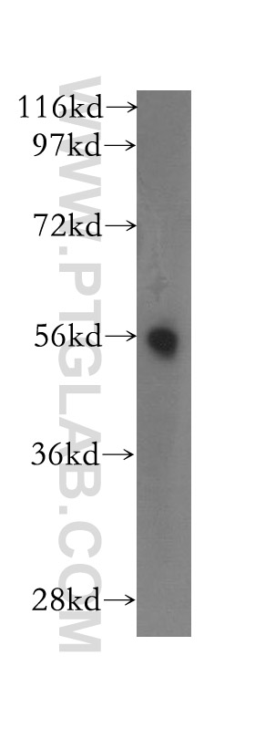 12033-1-AP;human lung tissue